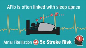 Sleep Apnea and Atrial Fibrillation